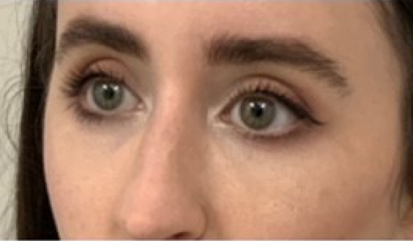 After-Eyes Result