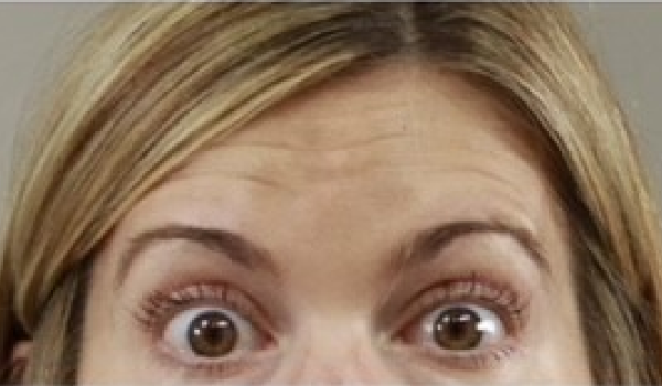 Before- Forehead Result